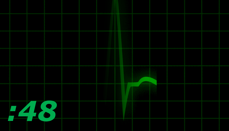 Paramedics: Clear! Pulse